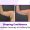 Top-Axillary-Breast-Surgery-clinic-in-Hyderabad
